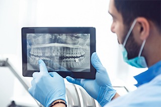 Implant dentist in Fort Worth pointing at a digital X-ray