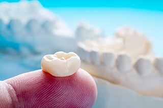 a dental crown being placed on a tooth model