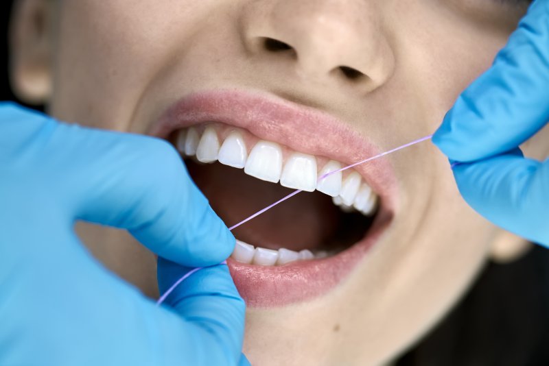 Gloved hands flossing a woman’s teeth