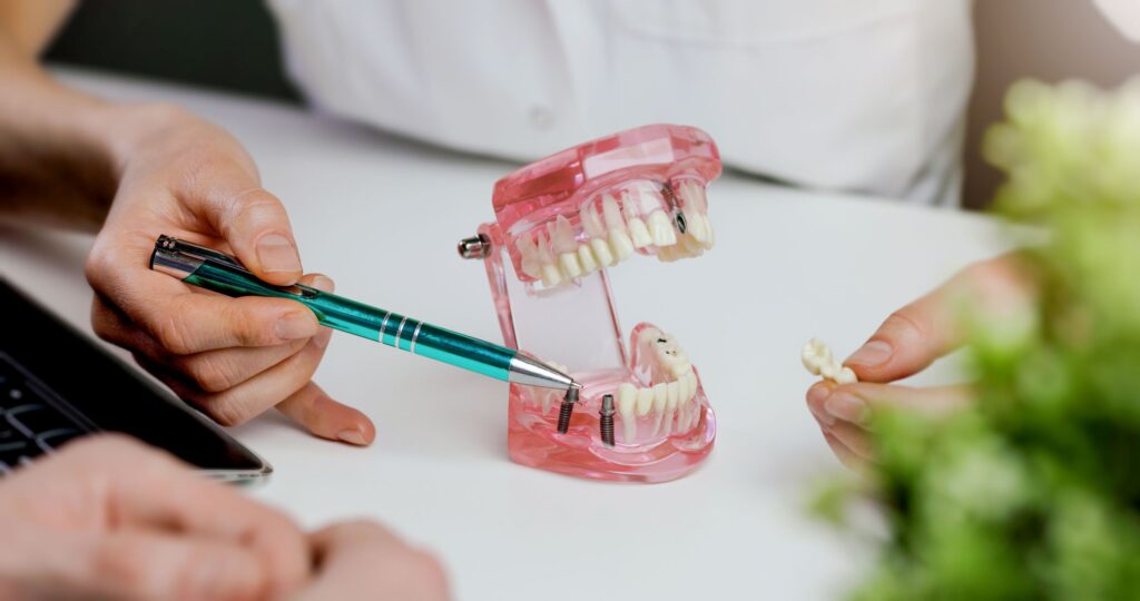 Dentist pointing to sample implants with pen 